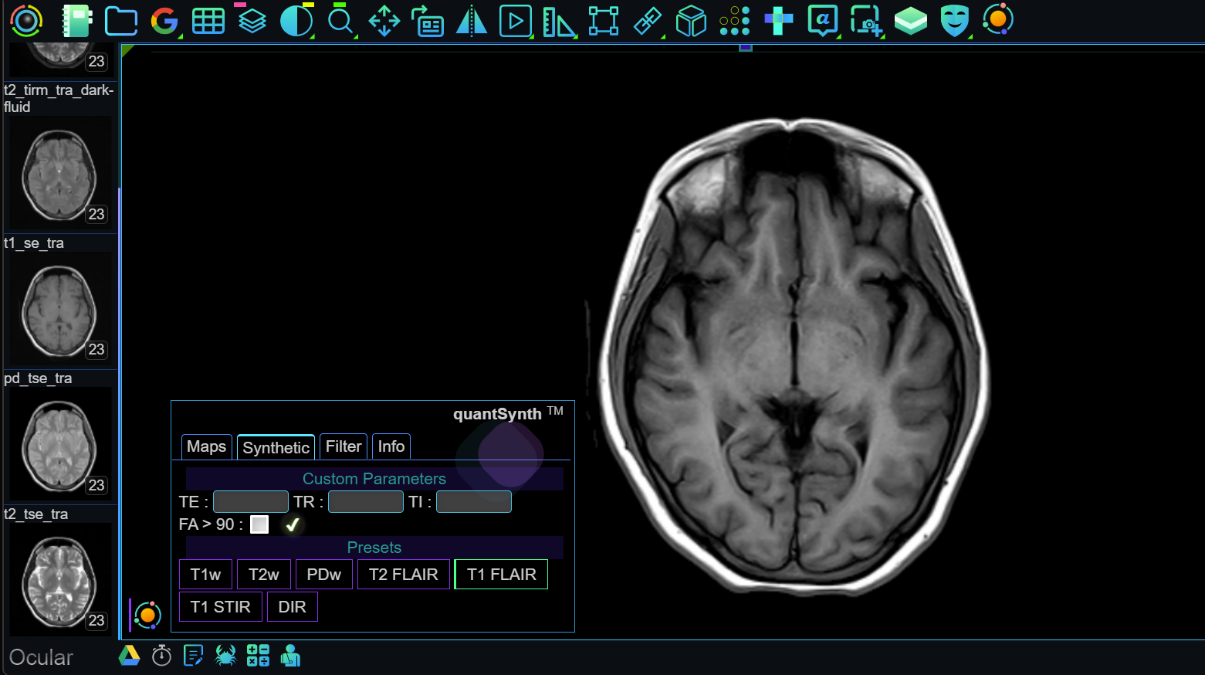 Synthesized T1 FLAIR Image